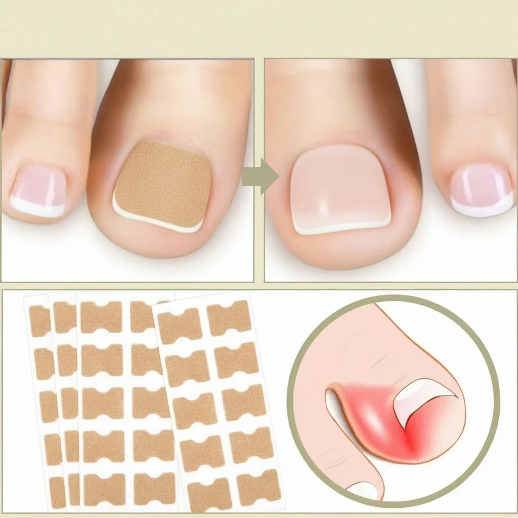 Nail Repair Patches Ingrown Toenails Instant Relief & Healing