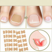 Nail Repair Patches Ingrown Toenails Instant Relief & Healing