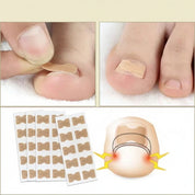 Nail Repair Patches Ingrown Toenails Instant Relief & Healing