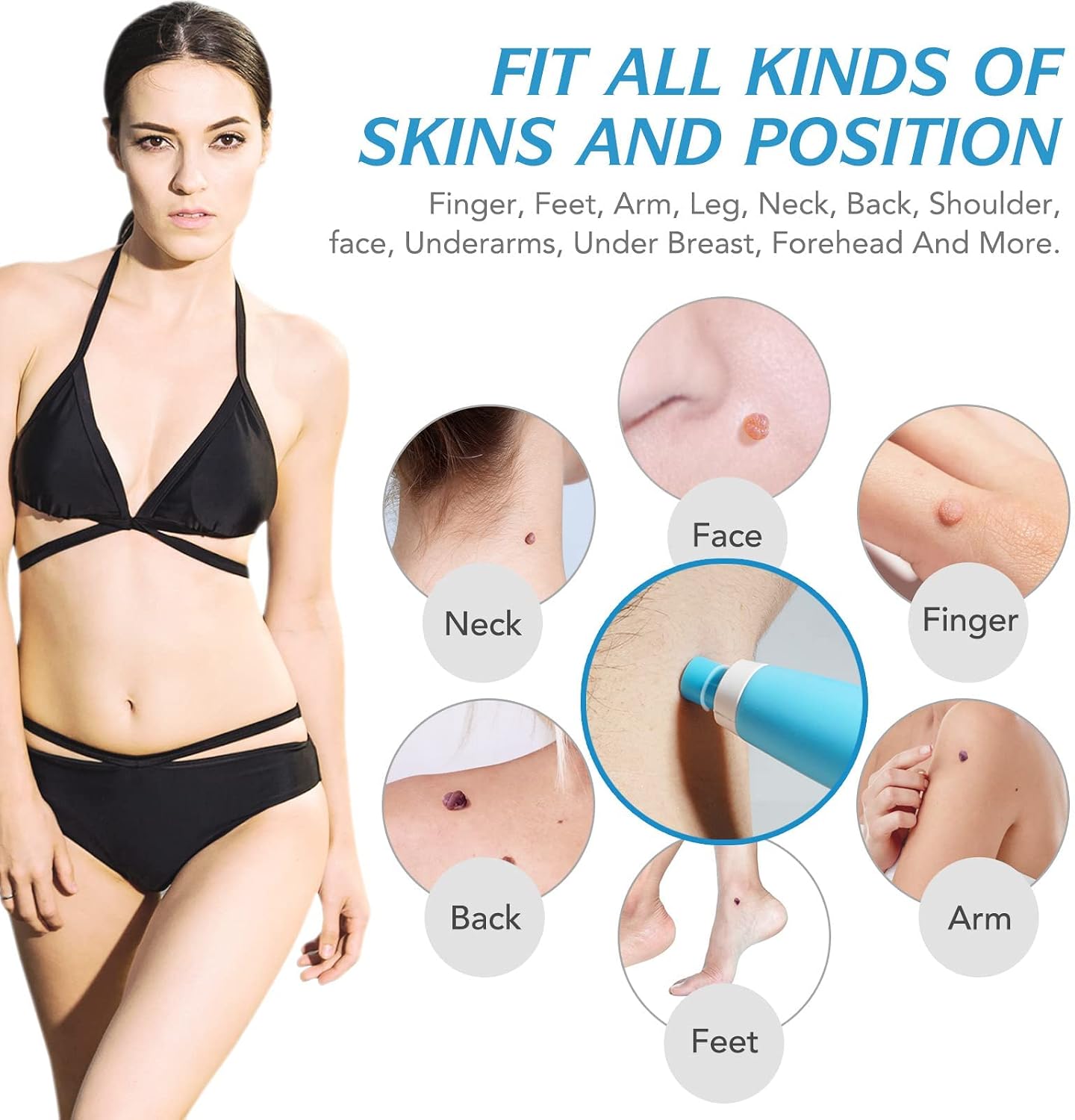 Auto Skin Tag Remover Kit Easy Removal Fast Results