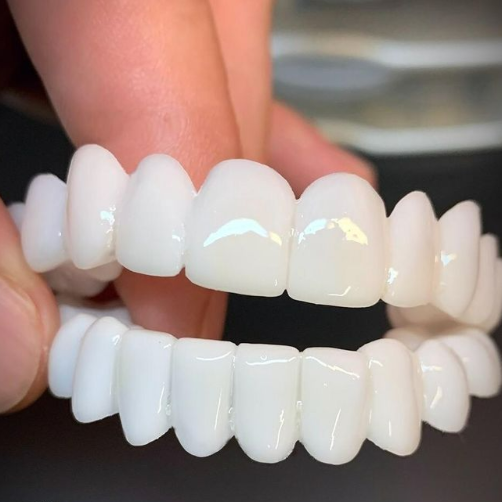 Dental Prosthesis Smile Enhancement Custom Fit Teeth Replacement - Image 2