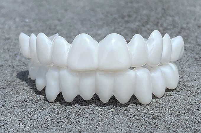 Dental Prosthesis Smile Enhancement Custom Fit Teeth Replacement - Image 3