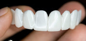 Dental Prosthesis Smile Enhancement Custom Fit Teeth Replacement - Image 4