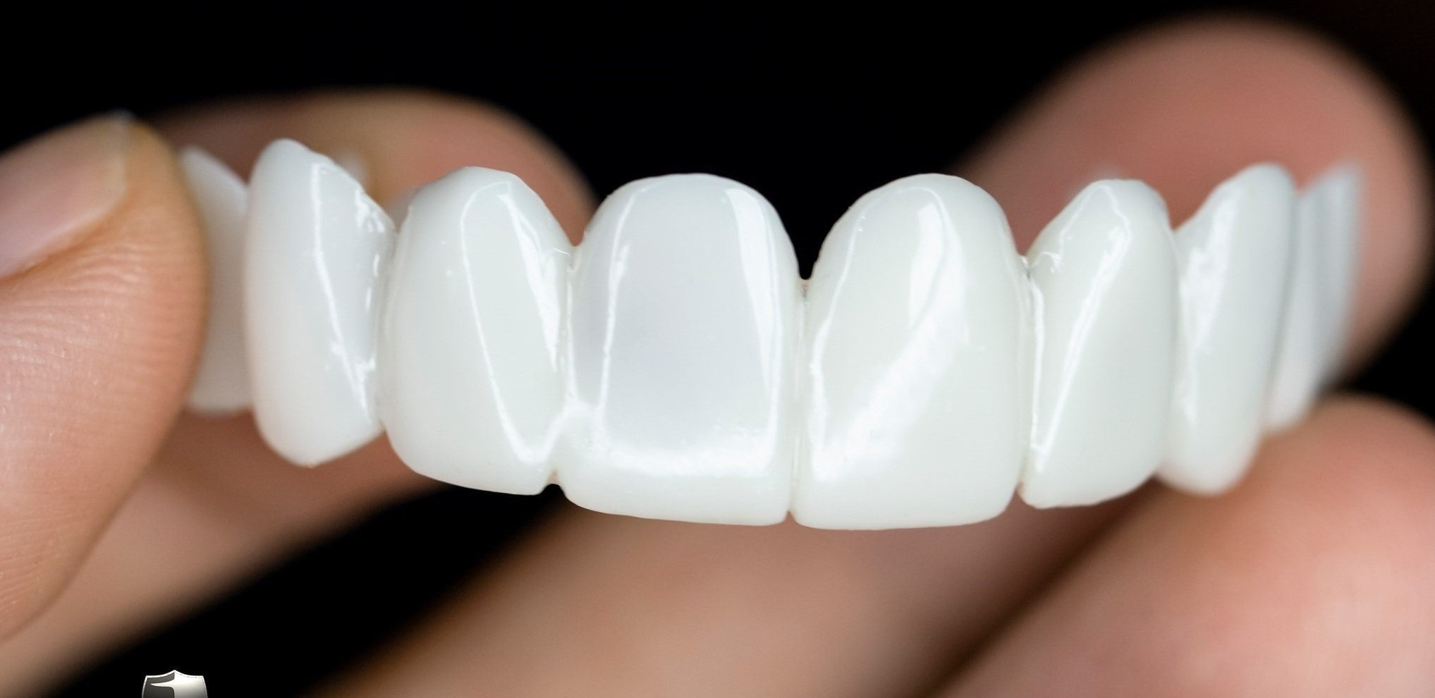 Dental Prosthesis Smile Enhancement Custom Fit Teeth Replacement - Image 4