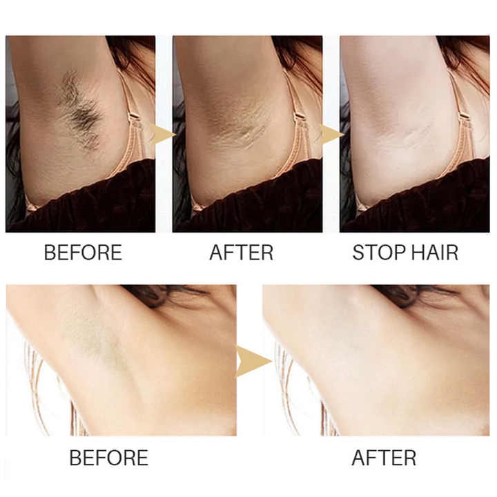 Hair Inhibitor Serum Smooth Skin Pain-Free Hair Removal 1+1 Free - Image 2