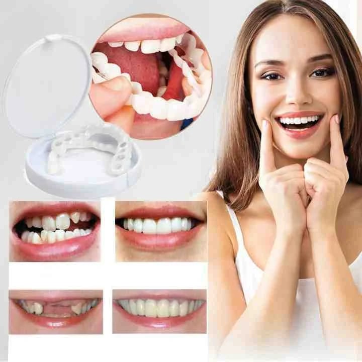 Instant Veneers Upper and Lower Jaw Natural Look Teeth Covering - Image 1