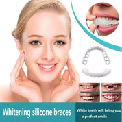 Instant Veneers Upper and Lower Jaw Natural Look Teeth Covering - Image 4