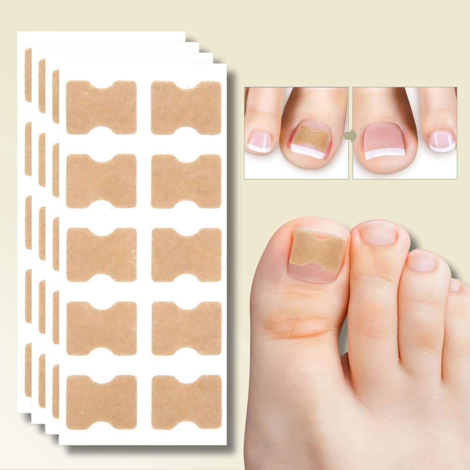 Nail Repair Patches Ingrown Toenails Instant Relief & Healing - Image 1