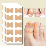 Nail Repair Patches Ingrown Toenails Instant Relief & Healing - Image 1