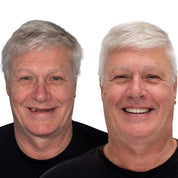 Natural-Looking Dentures Comfort and Confidence Smiles - Image 11