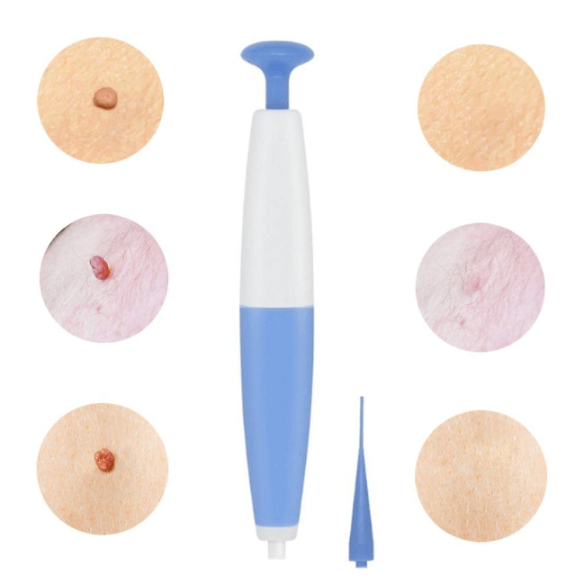 Skin Tag Removal Kit Safe and Easy Beauty Treatments Home - Image 5