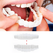 Smile Veneer Teeth Cover Set Instant Smile Makeover Upper & Lower - Image 1