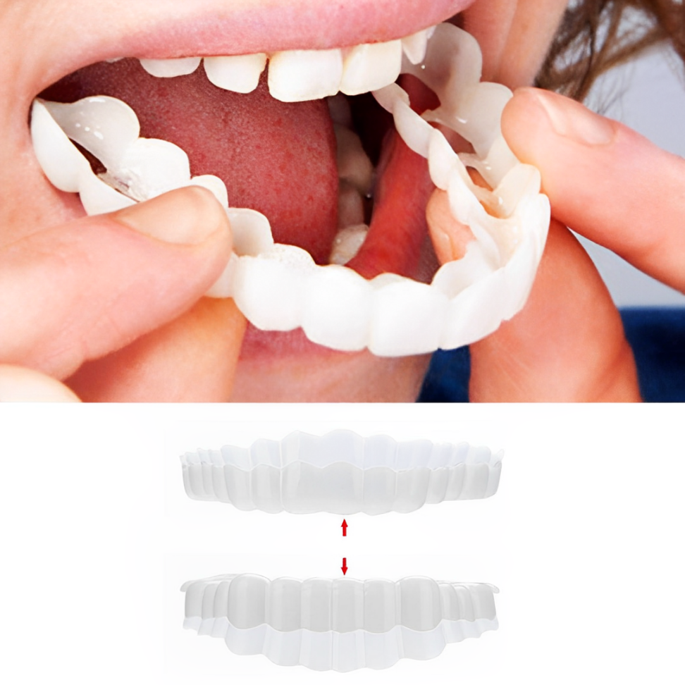 Smile Veneer Teeth Cover Set Instant Smile Makeover Upper & Lower - Image 1