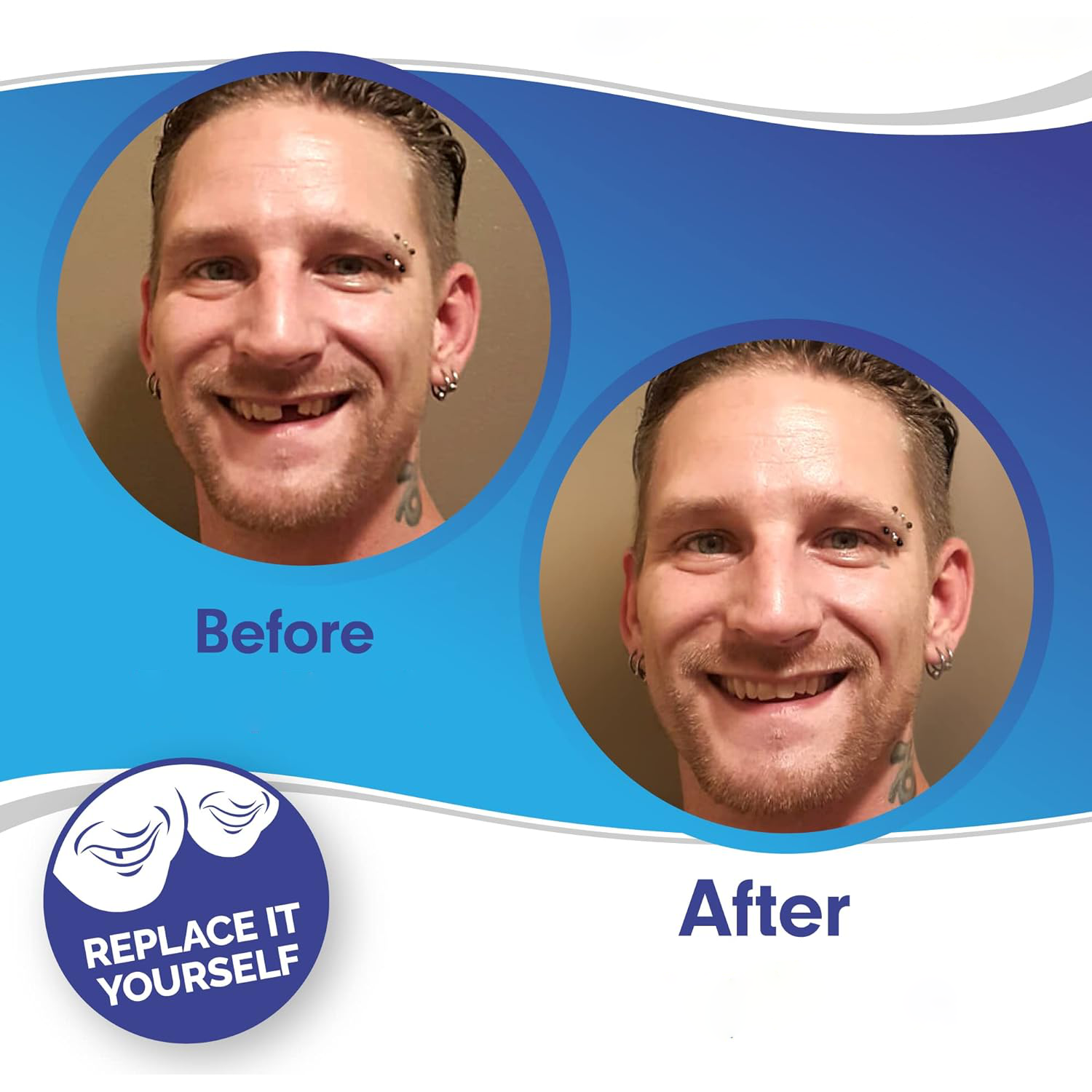 Smile Veneer Teeth Cover Set Instant Smile Makeover Upper & Lower - Image 2