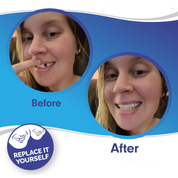 Smile Veneer Teeth Cover Set Instant Smile Makeover Upper & Lower - Image 3