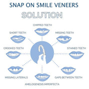Smile Veneer Teeth Cover Set Instant Smile Makeover Upper & Lower - Image 6