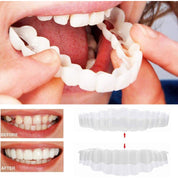 Smile Veneer Teeth Cover Set Instant Smile Makeover Upper & Lower - Image 9