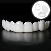 Snap-On Teeth Veneers Instant Smile Correction and Dental Aesthetics - Image 1