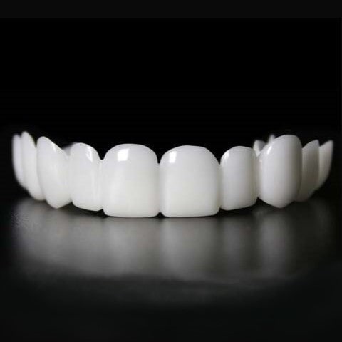 Snap-On Teeth Veneers Instant Smile Correction and Dental Aesthetics - Image 3